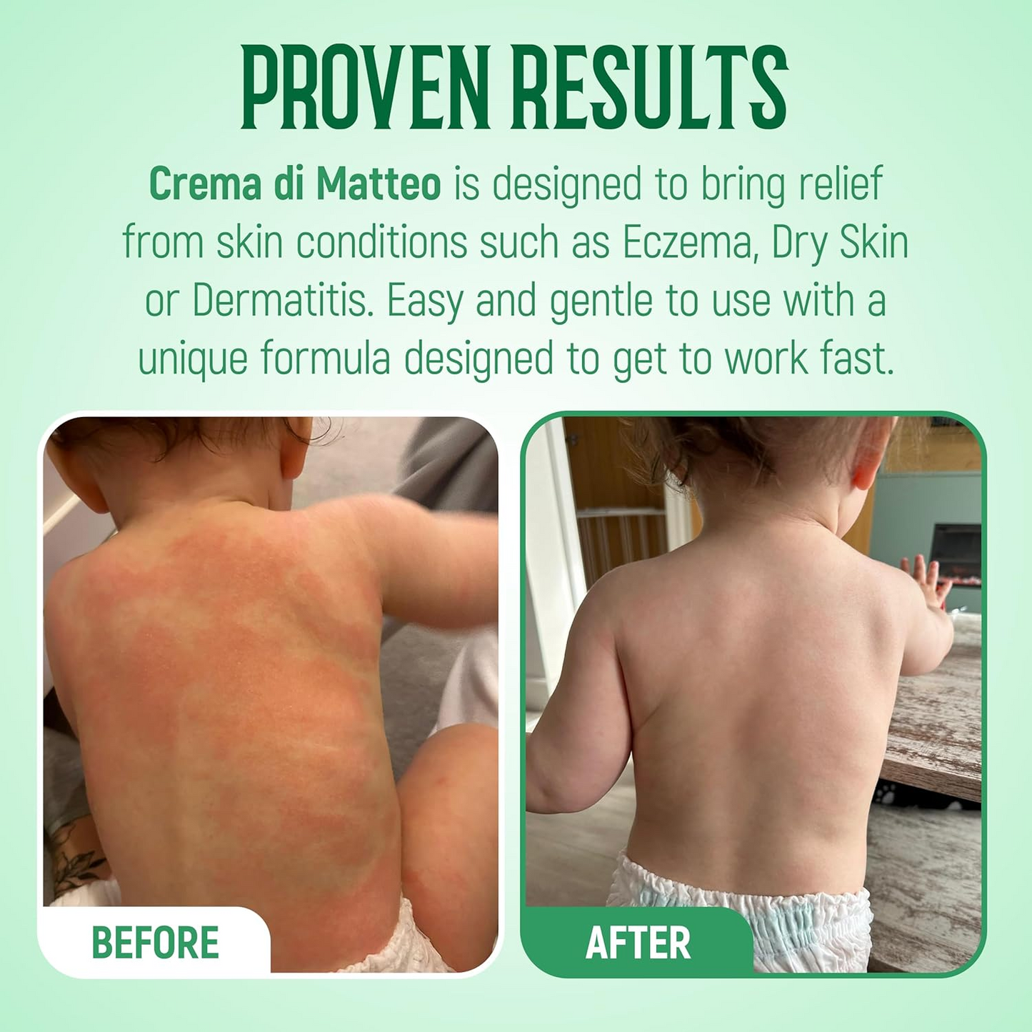 1936 Original Crema Di Matteo Cream - 100ml | Natural Eczema Relief for All Ages | Gentle Daily Moisturizer